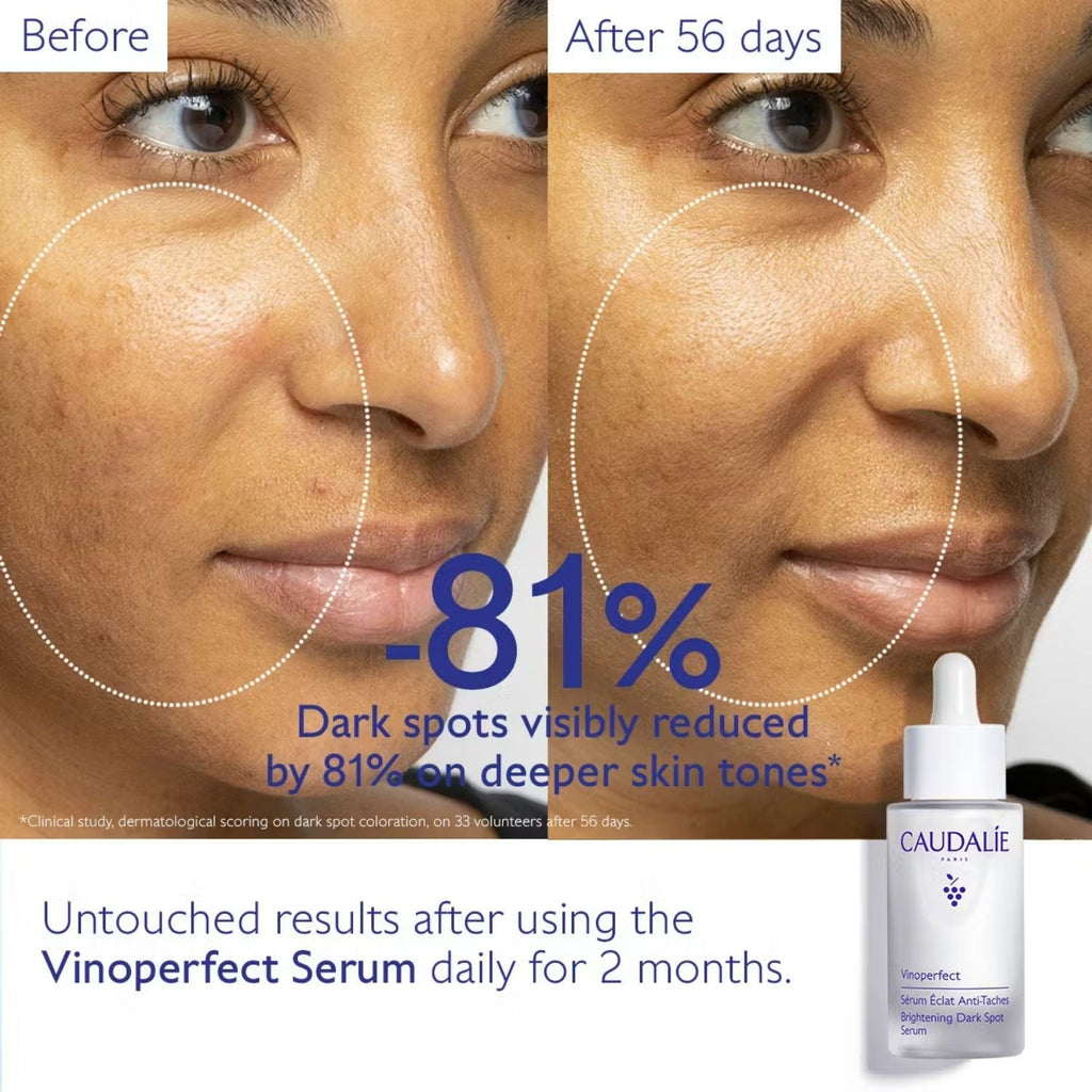 Caudalie Vinoperfect Serum with Viniferine