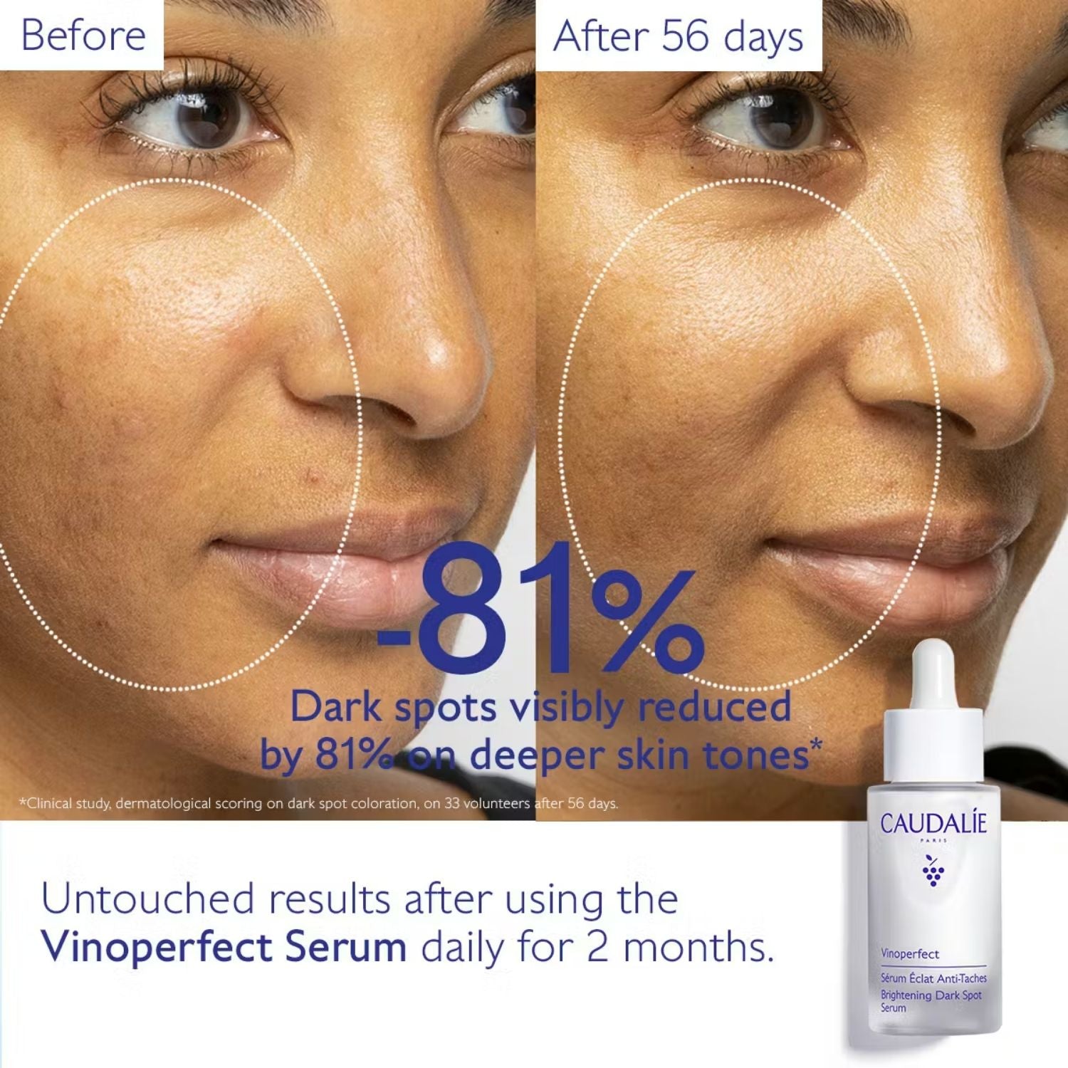 Caudalie Vinoperfect Serum with Viniferine